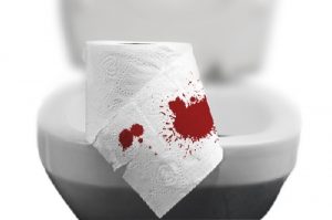 Bị chảy máu mỗi khi đi đại tiện