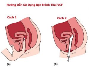 Cách sử dụng màng phim tránh thai hiệu quả nhất VCF