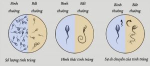 Vậy Xuất tinh sớm có ảnh hưởng đến chất lượng tinh trùng không?