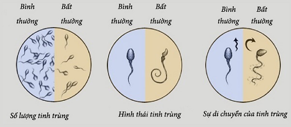 Tinh dịch như thế nào là bình thường?