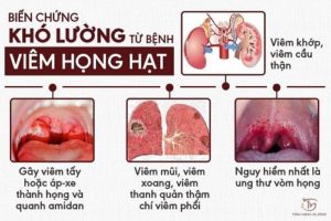 Viêm họng hạt có nguy hiểm không?
