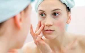 Ngưng sử dụng mỹ phẩm gây dị ứng da