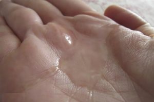 Tinh dịch có màu trong như nước lã