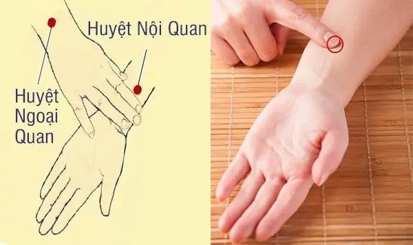 Bấm huyệt chữa xuất tinh sớm - Huyệt nội quan nằm ở vị trí nào?