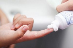 Thuốc bôi bị ngứa hậu môn
