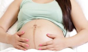 Kinh nghiệm bầu con trai – đường lông ở bụng