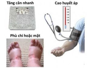 Cân nặng tăng nhanh