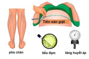 Triệu chứng của tiền sản giật