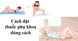 Cách đặt thuốc vào vùng kín